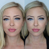 Cheekbone contouring - before and after photos from the California Cosmetics Med Spa in Corona.