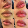 PERFECT Pout JUVEDERM Package