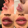 PERFECT Pout JUVEDERM Package