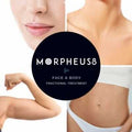 Morpheus8 RF Microneedling Treatment